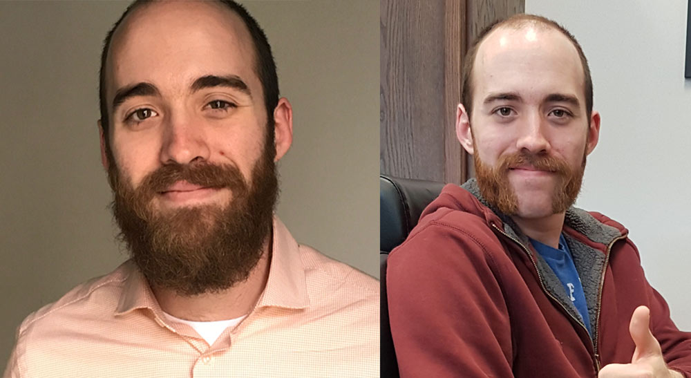 nick_before-after-jpg